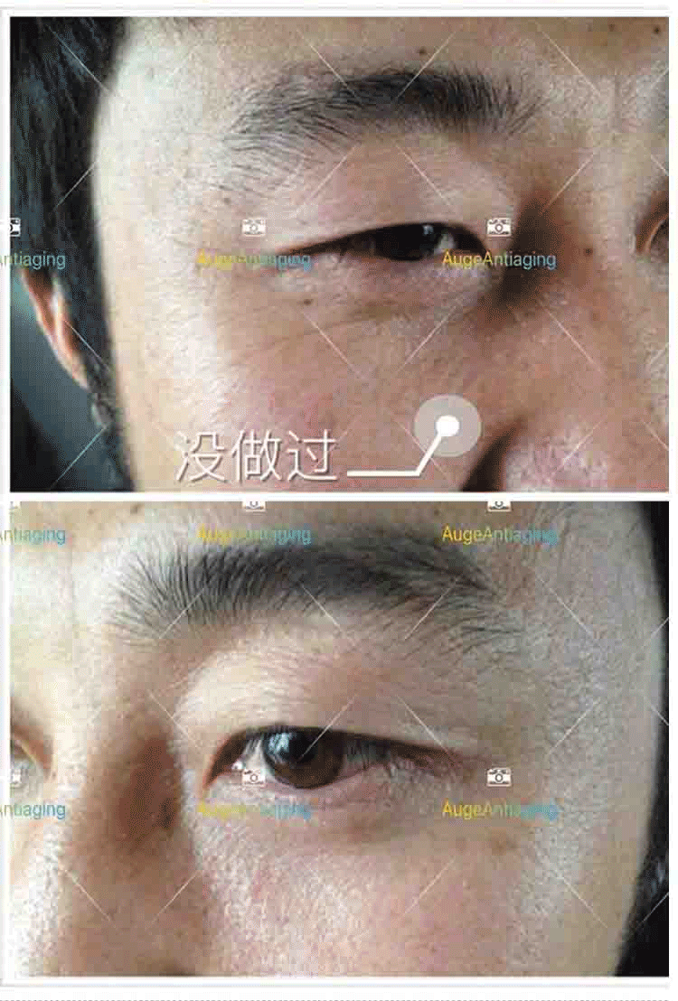 客户使用产品后的对比1(图1)