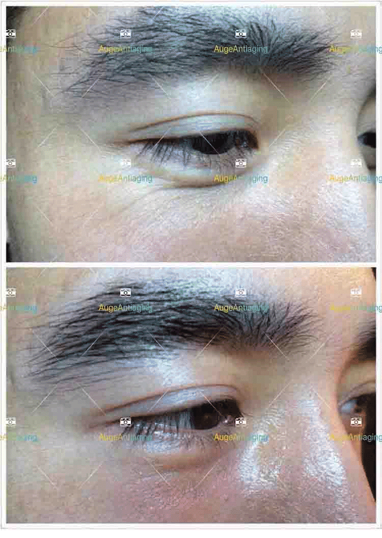 客户使用产品后的对比2(图1)