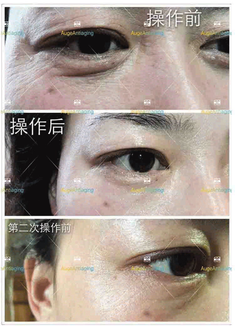 客户使用产品后的对比5(图1)