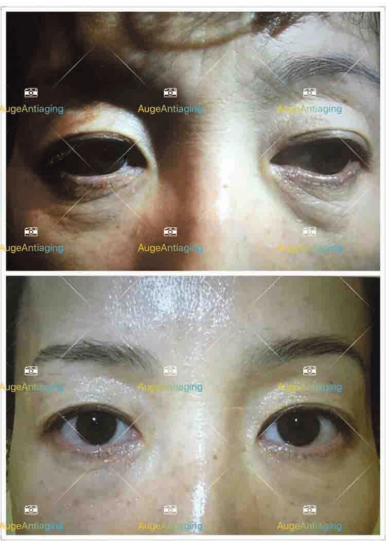 客户使用产品后的对比3(图1)