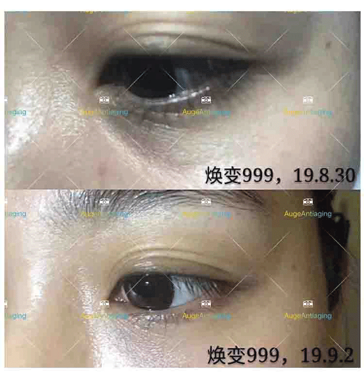 客户使用产品后的对比（999）(图1)