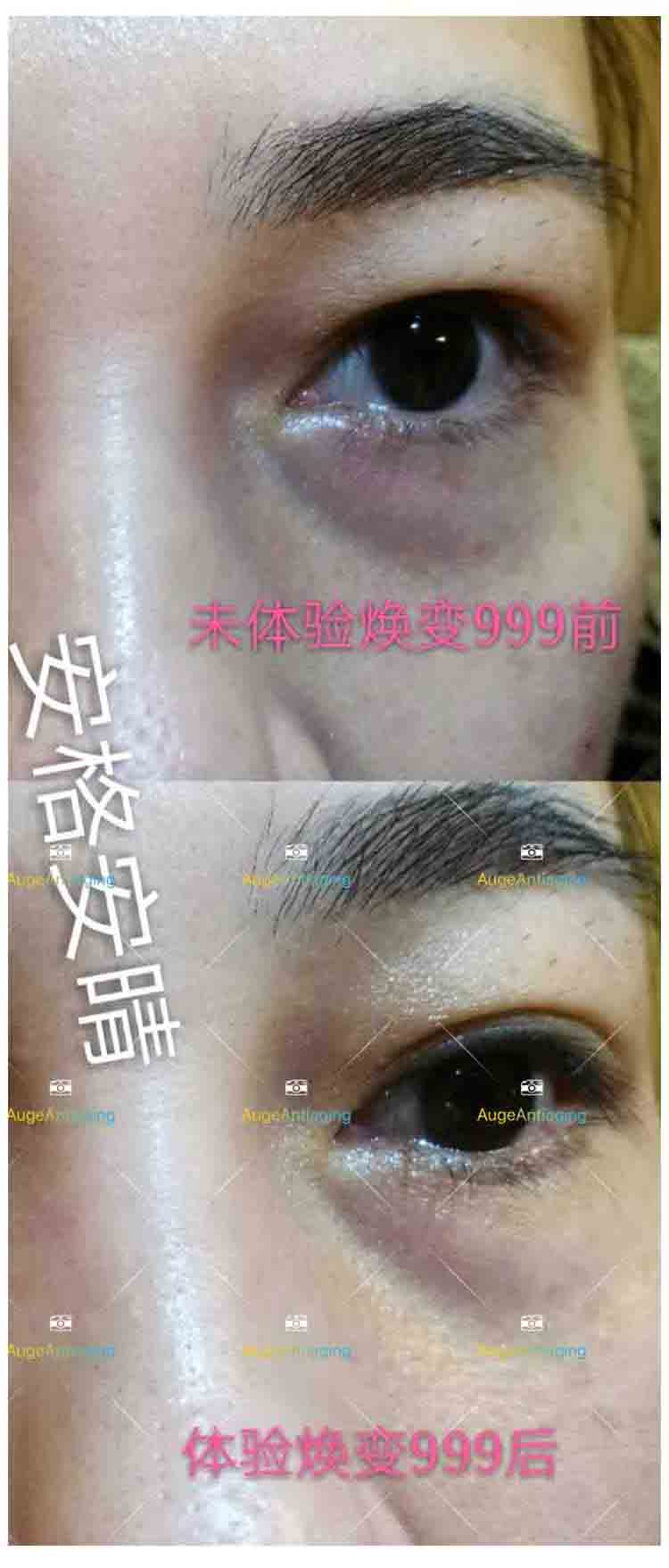 客户使用产品后的对比（999）(图1)