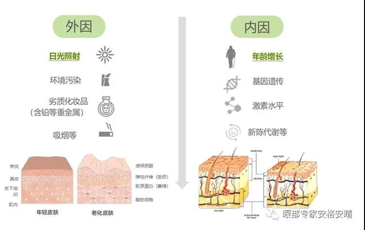 影响眼周衰老的几大因素，快来看看可以避免踩坑(图3)