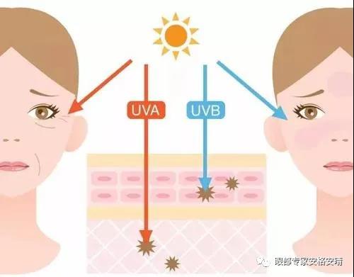 影响眼周衰老的几大因素，快来看看可以避免踩坑(图4)