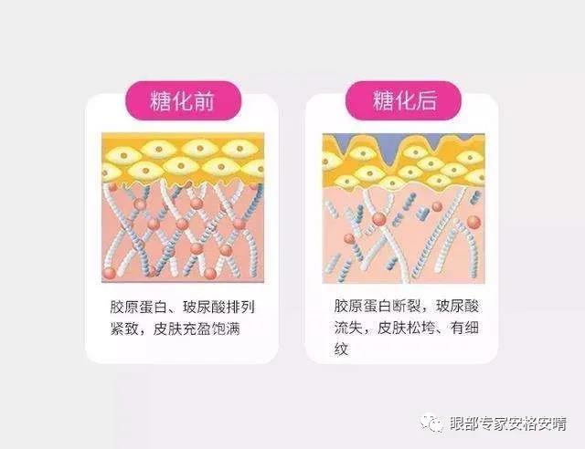 影响眼周衰老的几大因素，快来看看可以避免踩坑(图6)