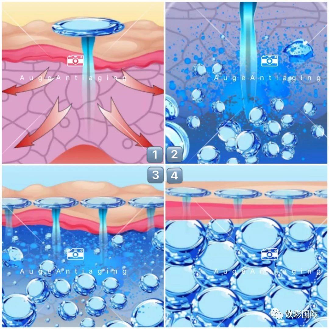 AugeAntiaging || 直达肌底吸收，肌肤饱满看得见！(图6)