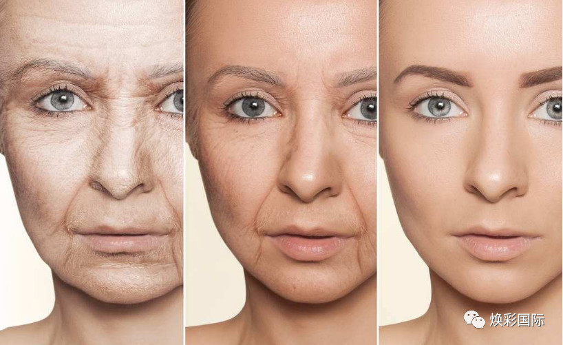 AugeAntiaging || 直达肌底吸收，肌肤饱满看得见！(图3)