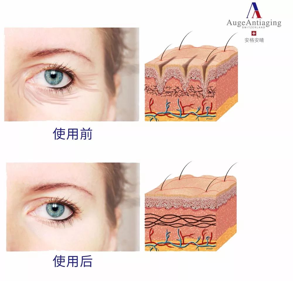 【焕彩国际】胶原蛋白对皮肤的意义和作用(图7)