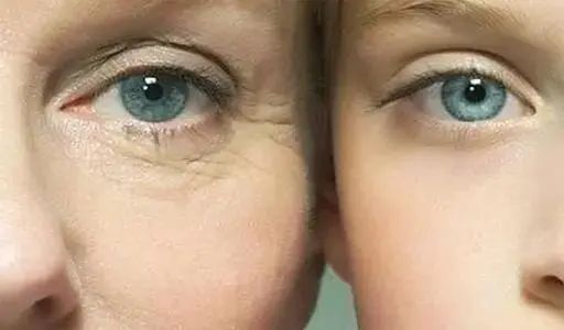 人老眼先衰！这4个现象，是眼部衰老的征兆！(图3)