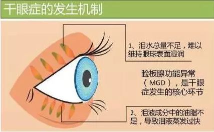 【爱眼护眼】遭遇伤害，眼睛也会求救(图5)